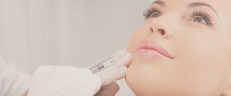 Woman preparing for lip injections by APT Medical Aesthetics