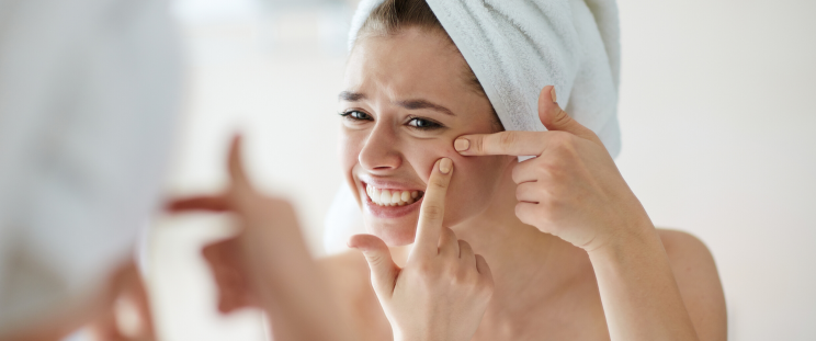 The Top 5 Treatments for Acne