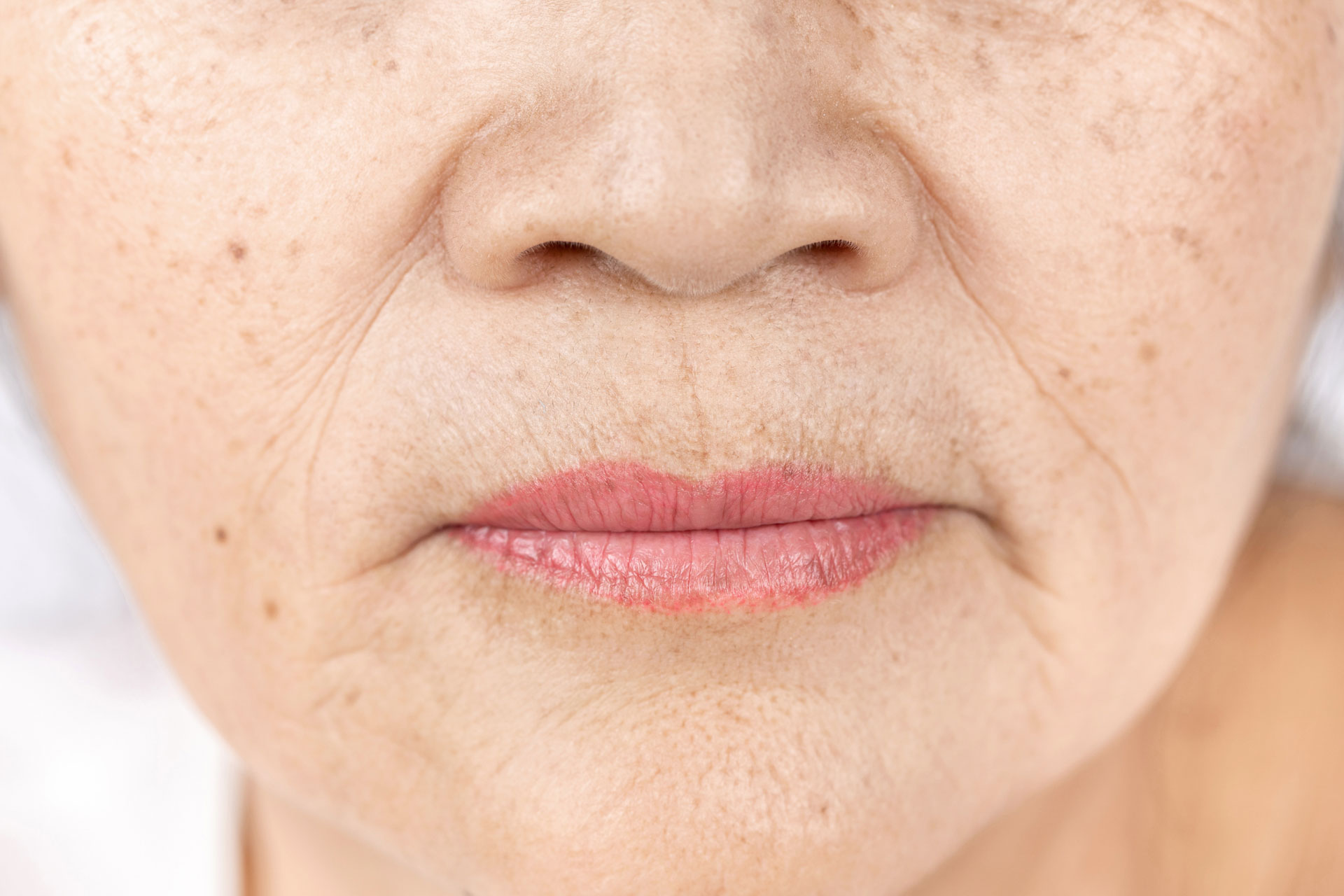 A close-up of a woman’s face showing brown spots, fine lines, and wrinkles 