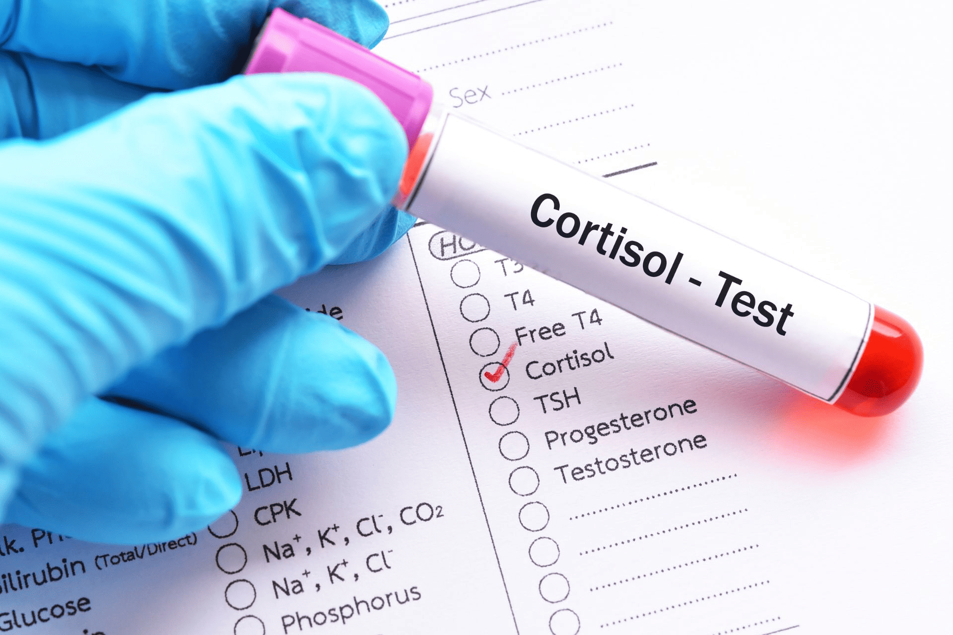 A cortisol test to determine hormone levels.

